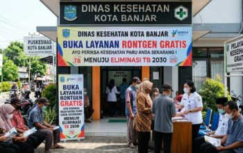 Bebas Penyakit TB 2030, Dinas Kesehatan Kota Banjar Buka Layanan Gratis Rontgen